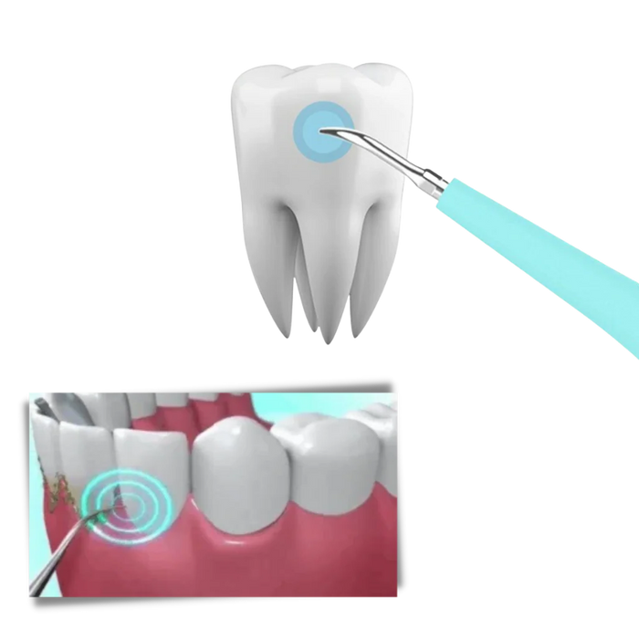 Deep Cleaning Tooth Tartar Machine