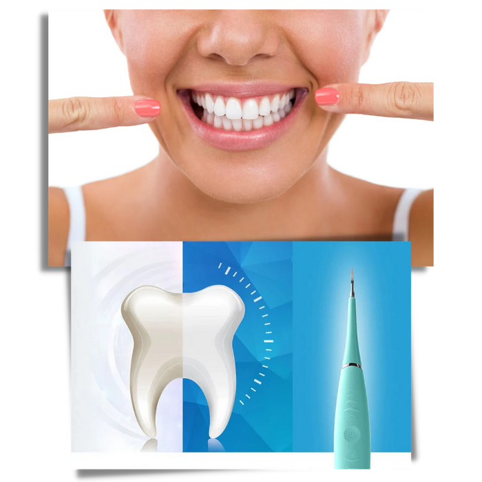 Deep Cleaning Tooth Tartar Machine