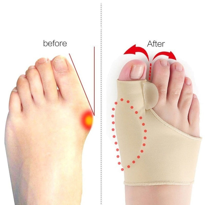 1 Pair Gel Bunion Toe Alignment Corrector Hallux Valgus Bunion Corrector Unisex