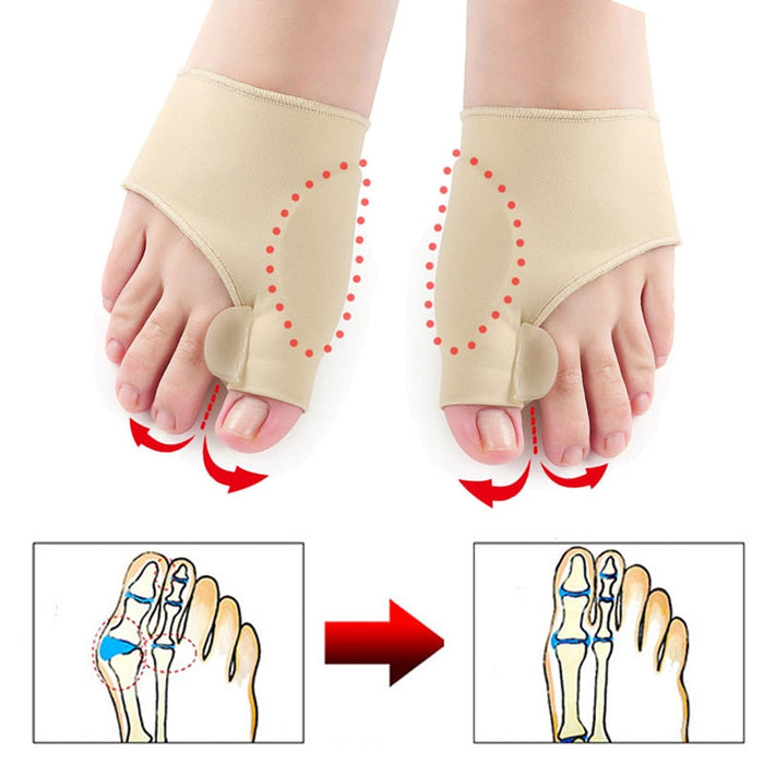 1 Pair Gel Bunion Toe Alignment Corrector Hallux Valgus Bunion Corrector Unisex